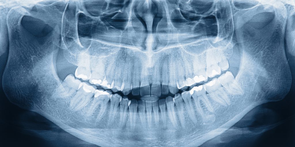 The Dr. Is In: Your Jaw and Your Voice